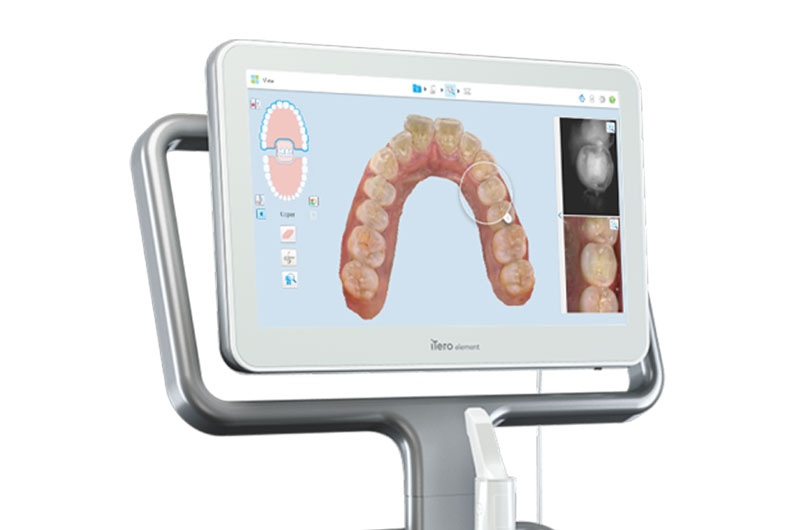 Craniofacial Dental Sleep Medicine